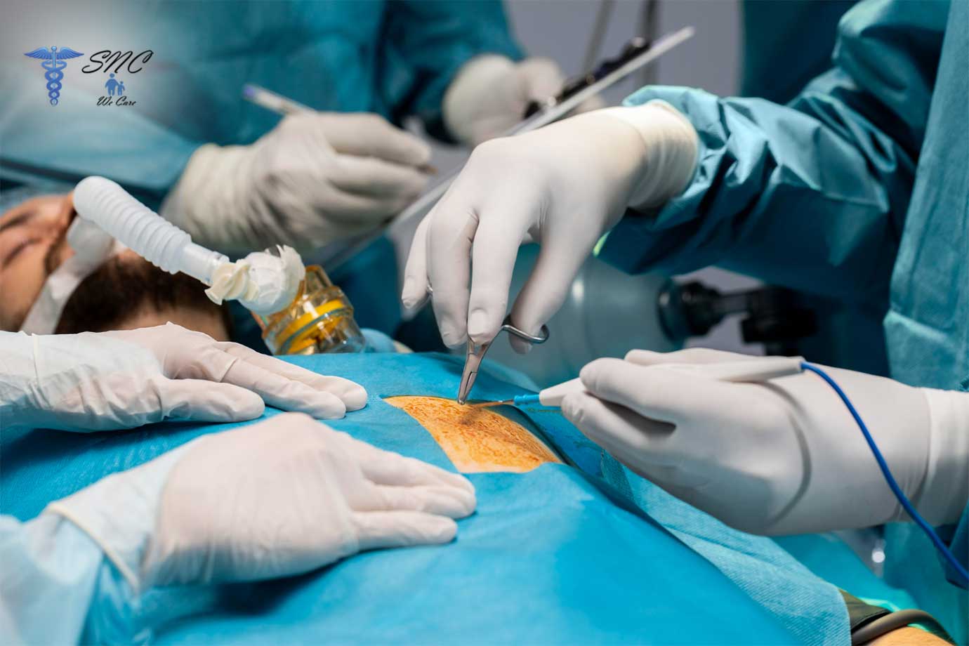 Hernia Surgery